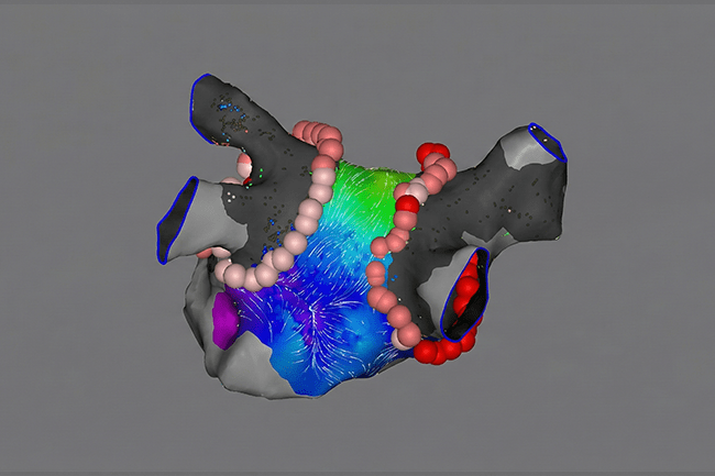 Cardialogy IMC