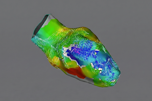 Cardialogy IMC